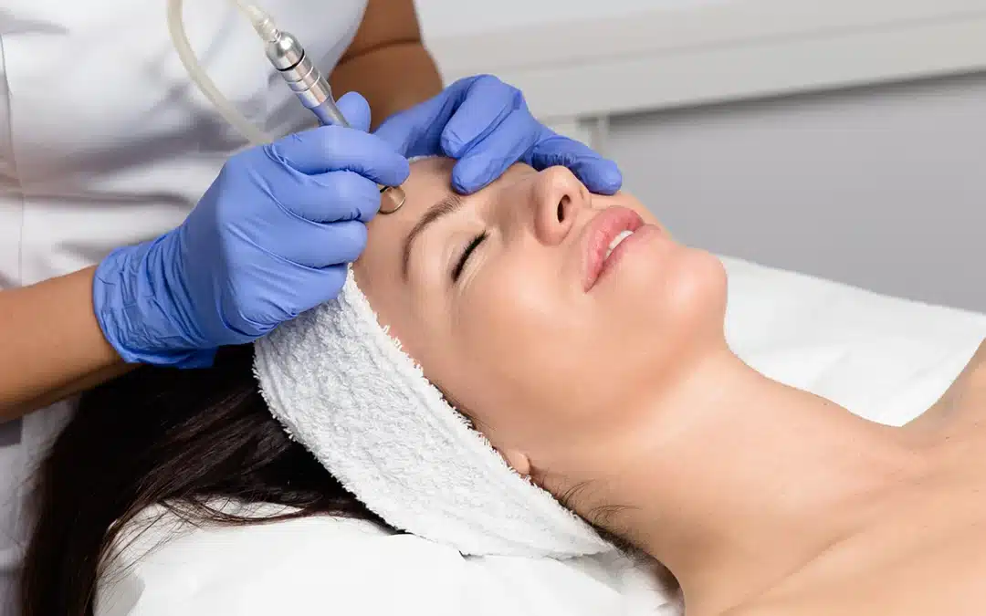 Microdermabrasion
