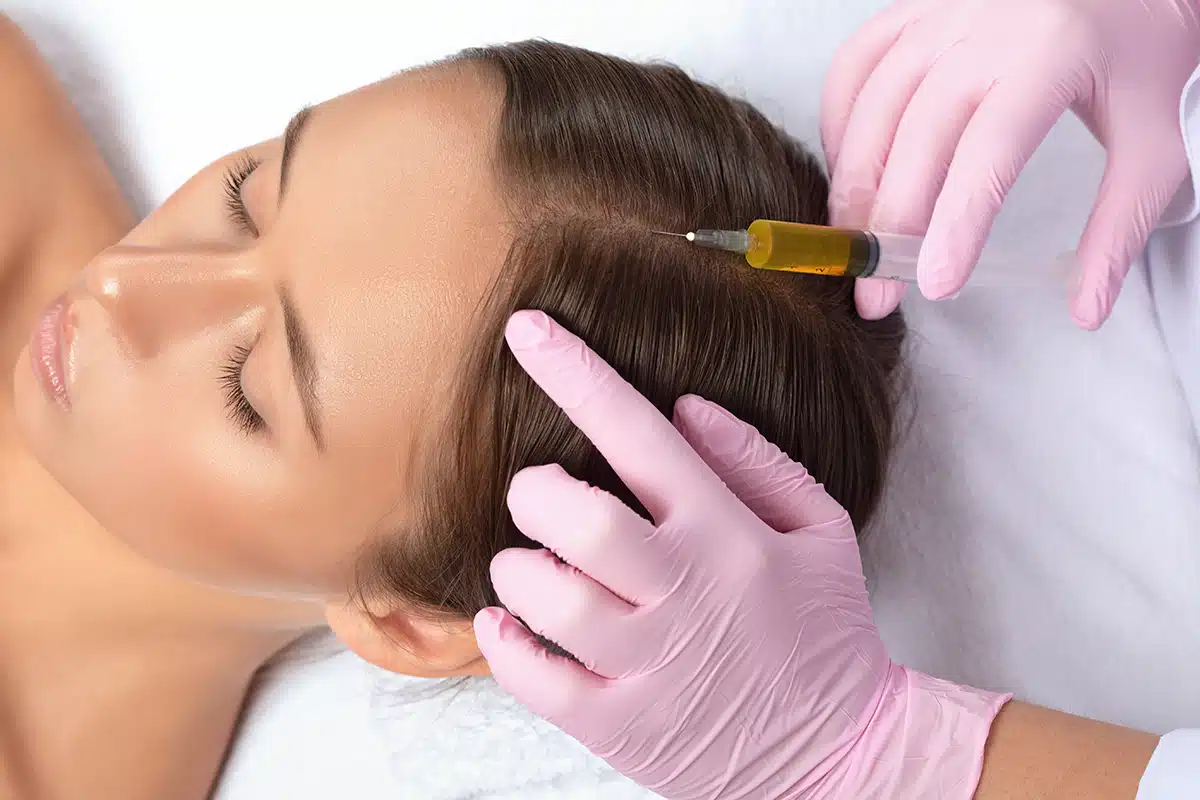 Cosmetologist does PRP therapy against hair loss