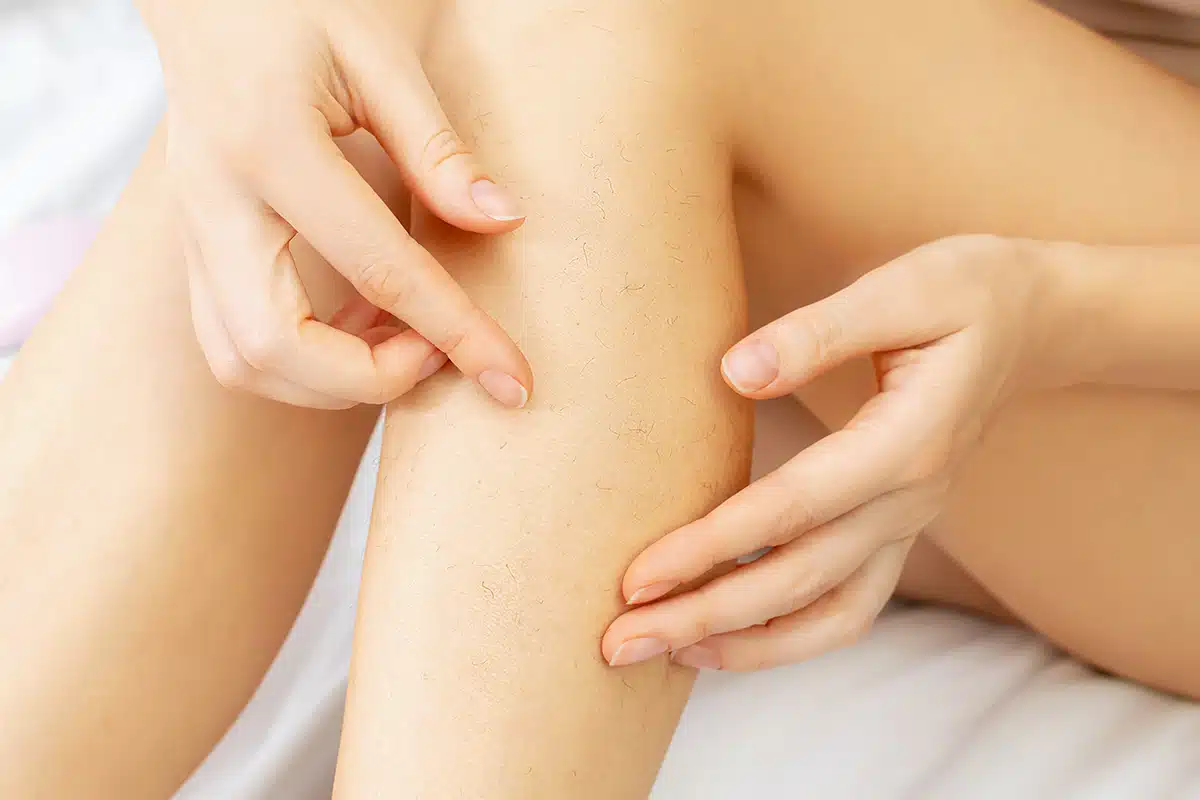 Hair removal depilation procedures for beauty