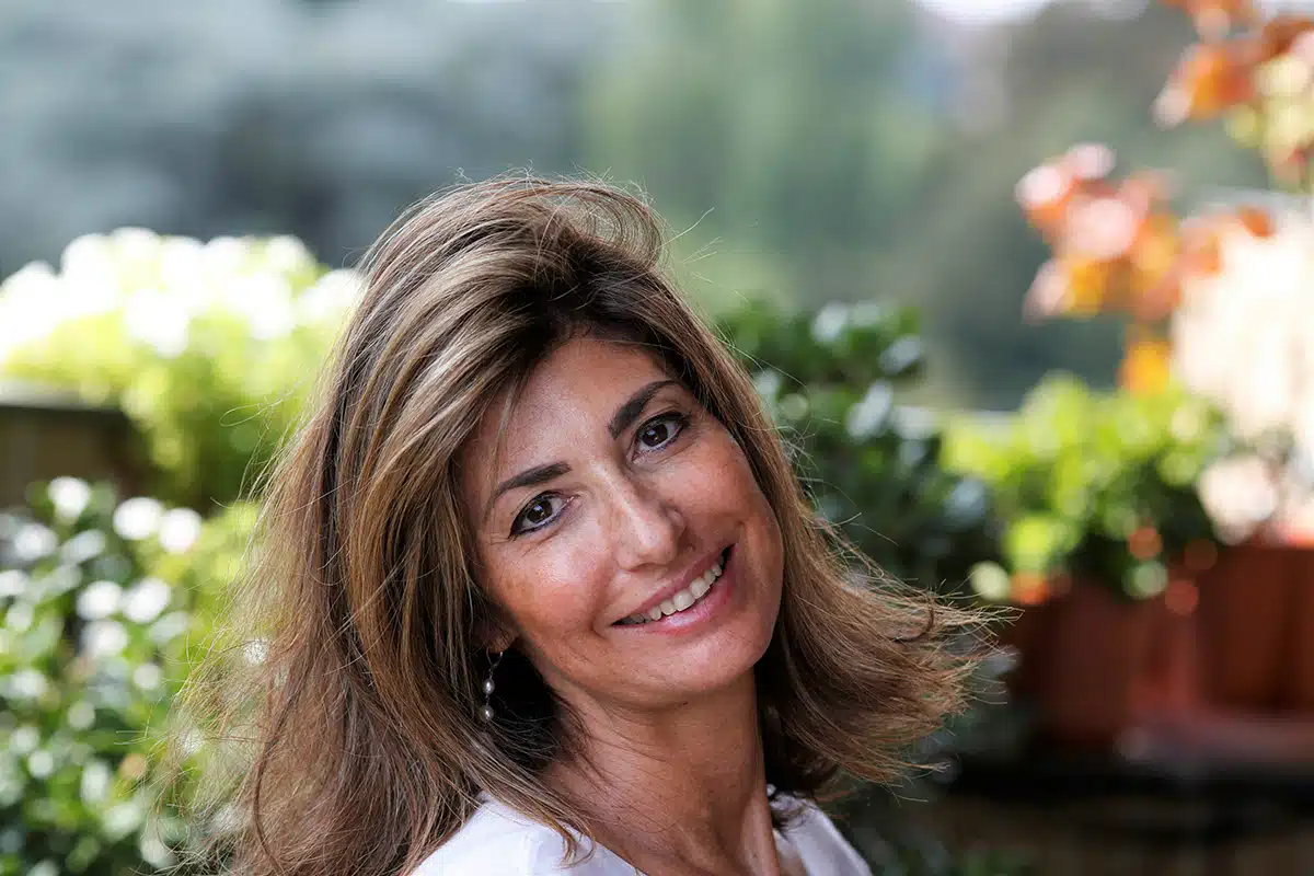 Middle-aged woman with skin pigmentation