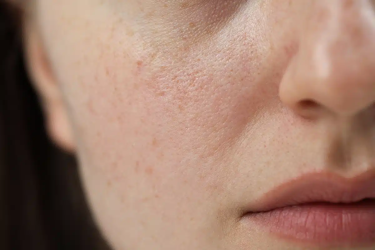 Woman with pigmented skin