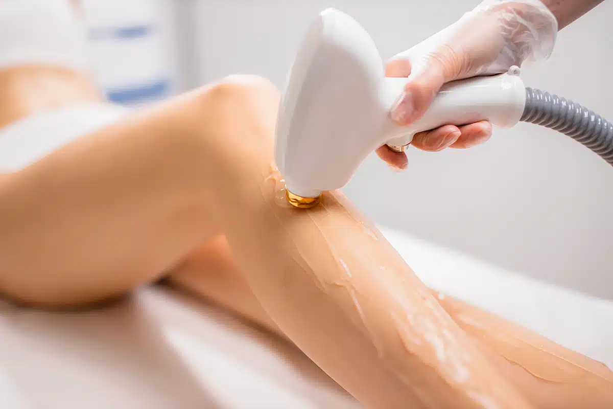 Woman's perfect legs while getting hair removal procedure